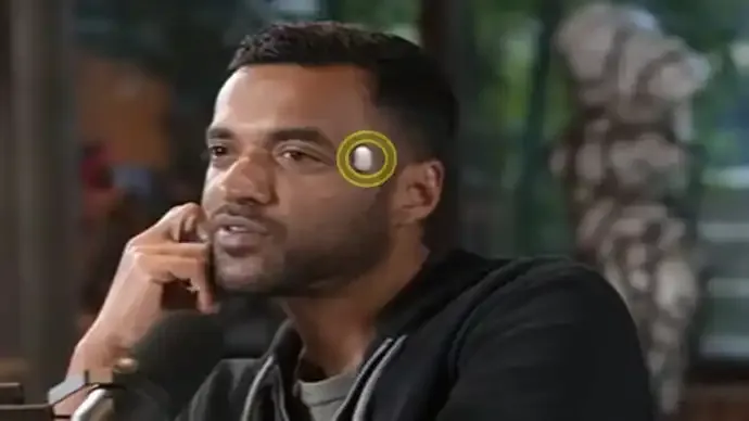 What Is the Device on Deepinder Goyal’s Temple? Brain Blood-Flow Wearable Explained