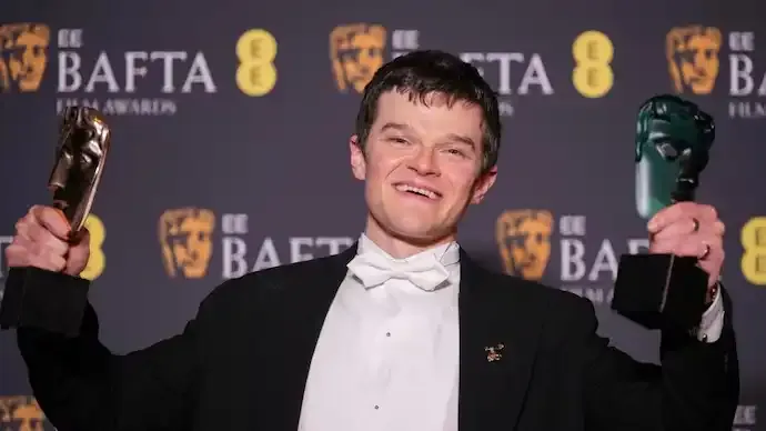 Robert Aramayo Wins BAFTA 2026 Best Actor, Beats DiCaprio and Chalamet
