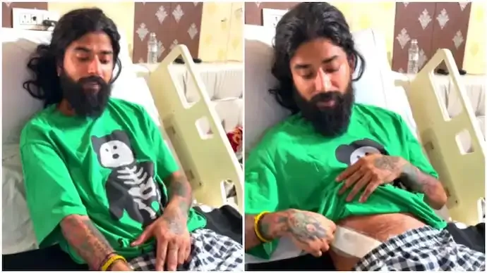 Anurag Dobhal Injury: Fears He May Not Walk Again