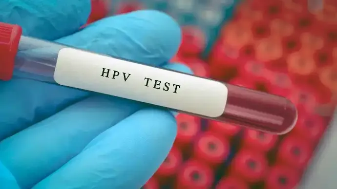 ICMR Licenses SHetA2 to Emcure: Could This Drug Replace Surgery for Stage 0 Cervical Cancer?