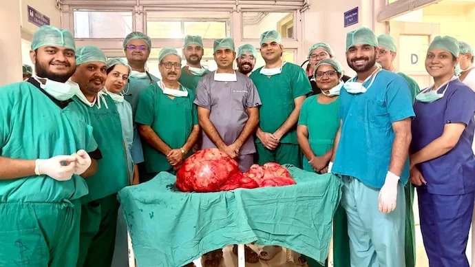 Doctors at SMS Hospital Jaipur remove a 28.6-kg retroperitoneal tumour